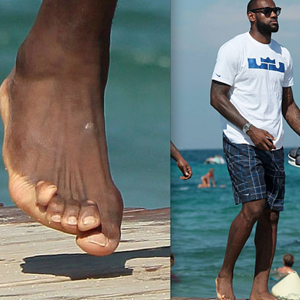 pictures of lebrons feet hammer toe